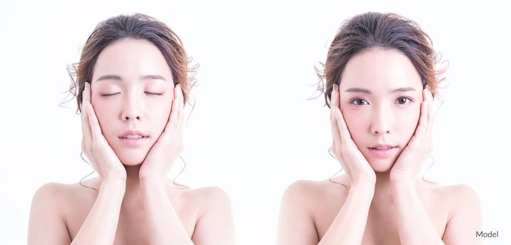 Model of asian descent with open and shut eyes. Side by side view.