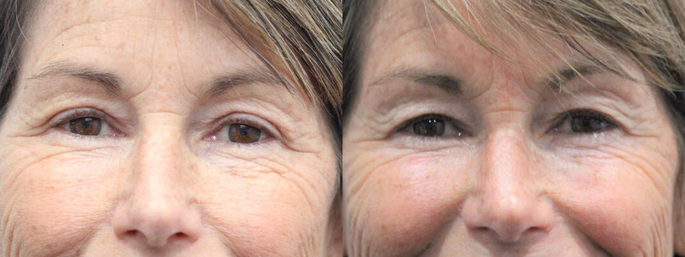 Actual patient results