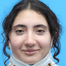 Rhinoplasty After Patient 1